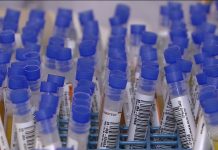 Coronavírus e enfrentamento ao genocídio bolsonarista