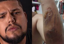 Justiça por Galo e fim da Polícia Militar!